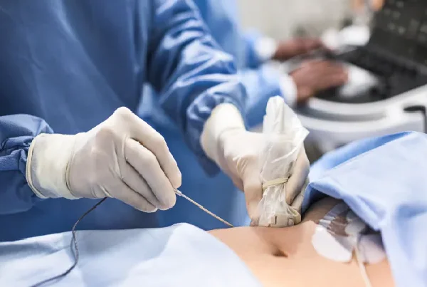 Interventional  Radiology